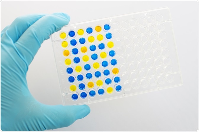 Enzyme-linked immunosorbent assay (ELISA), Immunology testing method in 96 wells microplate. Image Credit: Jarun Ontakrai / Shutterstock