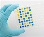 How Does Immunochemistry Work?