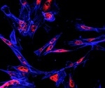 Combination therapy encourages innate immune cells to eat GBM tumors