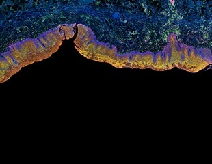 New Technique Enhances Three Dimensional Immunolabeling in Thick Tissues