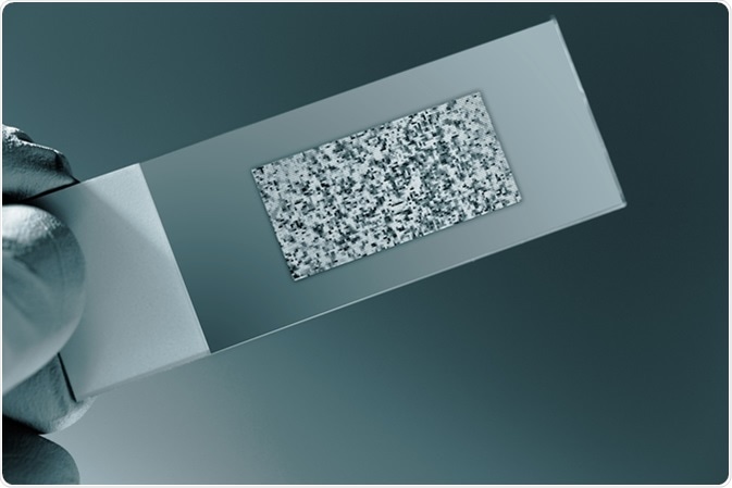 DNA microarray. Image Credit: Science Photo / Shutterstock