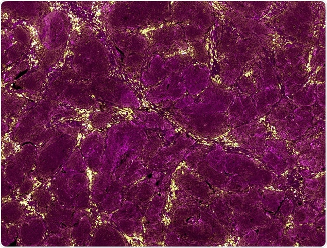 Immunohistochemistry is integral to many biology experiments