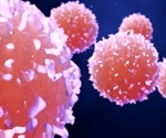 Study Offers New Insight into the Kinetics of Prostatic Inflammaging