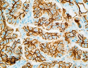 New Technique Enhances Three Dimensional Immunolabeling in Thick Tissues
