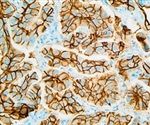 New Technique Enhances Three Dimensional Immunolabeling in Thick Tissues