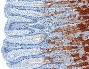 New Technique Enhances Three Dimensional Immunolabeling in Thick Tissues