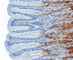 New Technique Enhances Three Dimensional Immunolabeling in Thick Tissues