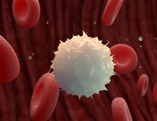 Study pinpoints a splicing deregulation that causes therapeutic vulnerability in pediatric AML