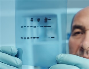 blotRig Tool Transforms Western Blot Design and Statistical Analysis for Reproducibility