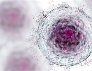 Study clarifies role of ERβ in growth and regeneration of skeletal muscle in female mice