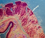 New fluorescent probe to detect damaged mitochondria could help treat neurodegenerative disorders