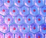 Personalized Mini-Brains Provide Insight into Autism Spectrum Disorder
