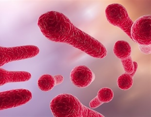 Microbiome-Based Approach Shows Promise for Treating Ulcerative Colitis