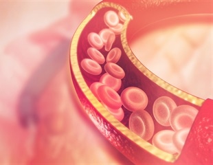 Blocking Cholesterol Metabolite May Prevent Parkinson's Disease Progression