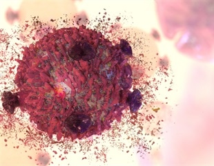 A New Understanding of the Effects of Fever on Immune Cells