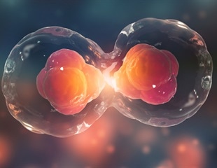 How Chromosomes Shape Up for Cell Division