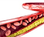 Study Uncovers Cholesterol's Role in Membrane Structure and Function