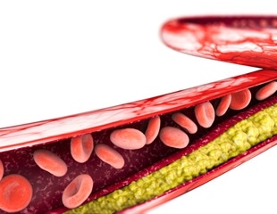 Biobank Data can Provide Insights into Genetic Architecture of Drug Response