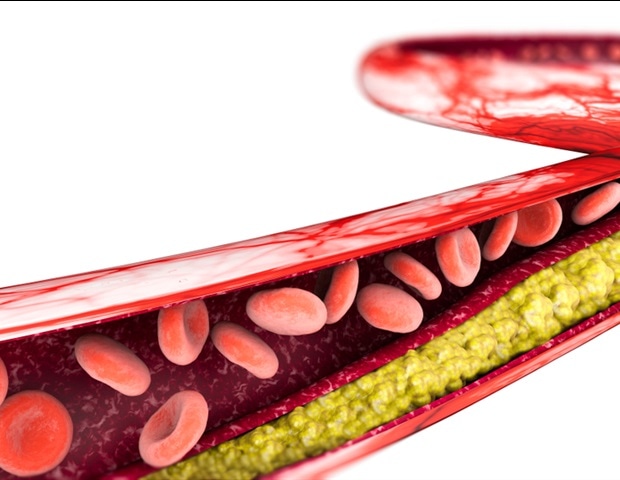 New Insights Into How Toxoplasma Parasites Trigger Host Cell Invasion