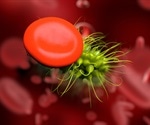 Electrochemical sensor for rapid detection of multiple sepsis biomarkers in whole blood
