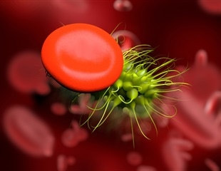 Electrochemical sensor for rapid detection of multiple sepsis biomarkers in whole blood