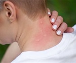 Global warming could increase the number and spread of fatal bacterial infections