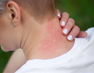 Global warming could increase the number and spread of fatal bacterial infections