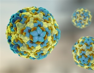 Carbon Dot-Based Fluorosensor Shows Superior Performance in Enterovirus RNA Detection