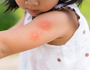 Global warming could increase the number and spread of fatal bacterial infections