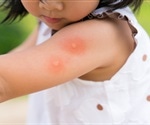 Global warming could increase the number and spread of fatal bacterial infections