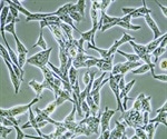 New Cell Model Paves Way for Faster Treatments for Neuromuscular Diseases