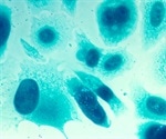 New test to detect substances that are harmful to the placenta and embryo