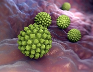 Xylem filters from native trees help purify drinking water