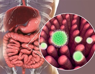 Gut Microbiota Modulates Rotavirus Vaccine Effectiveness