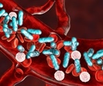 Electrochemical sensor for rapid detection of multiple sepsis biomarkers in whole blood