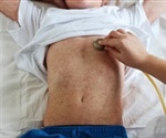 Infection with measles virus activates two different immune responses
