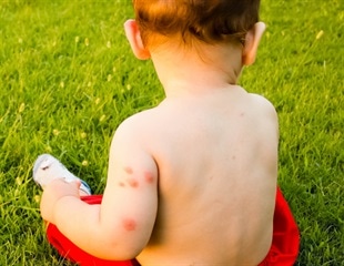 Global warming could increase the number and spread of fatal bacterial infections