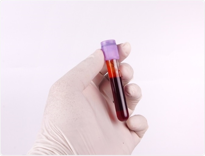 Blood sample being sent off for analysis.
