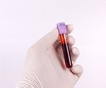 How Much CBD and THC Enters the Bloodstream?