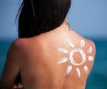 Unmasking the Molecular Mechanisms of Melanoma