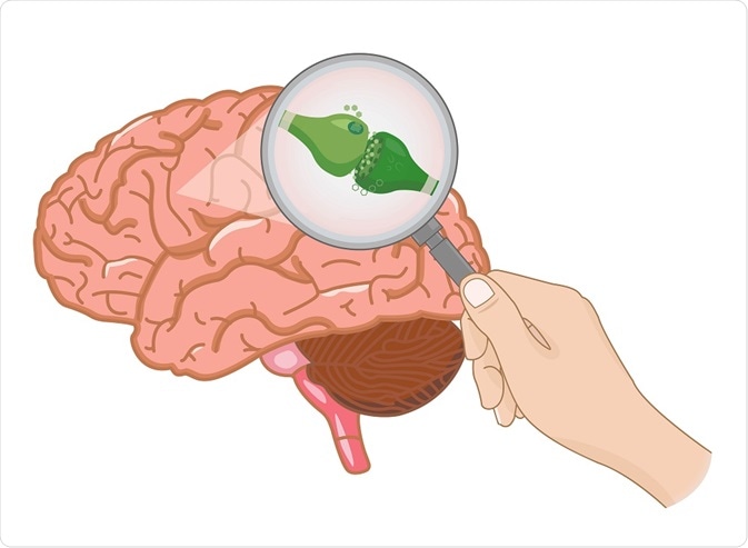 Lens into the brain