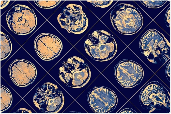 NMR image of human brain. Image Credit: sfam_photo / Shutterstock