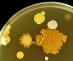 Research finds highest levels of pathogenic bacteria in urban and agricultural soils