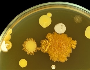 Symbiotic Bacteria Accompany Single-Celled Protists in the Ocean's Upper Layer