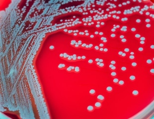 Princeton Engineers Discover How Soil Bacteria Balance Plant Growth and Immunity