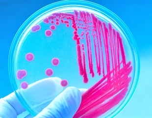 Unraveling the Evolutionary Link to Eukaryotic Cells