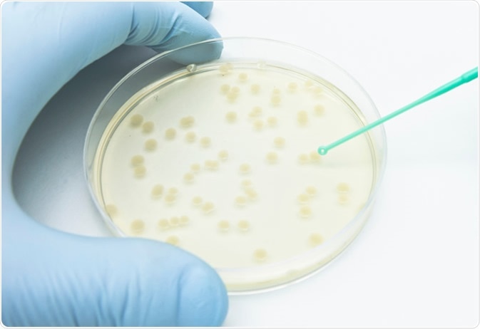 A researcher picking up bacterial colonies on the agar plate using a disposable loop. Image Credit: unoL / Shutterstock
