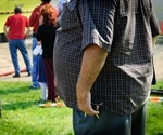 How Does the Gut Microbiome Influence Obesity?