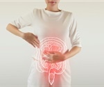 Unraveling the Genetic Roots of Anemia in Inflammatory Bowel Disease