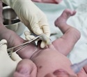 Scientists Identify Biological Link Between Low Birth Weight and Chronic Disease